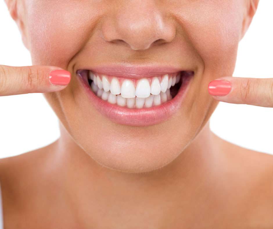 Teeth Whitening Bentleigh East | Top Cosmetic Dentist Melbourne