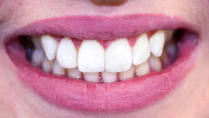 case-13-after