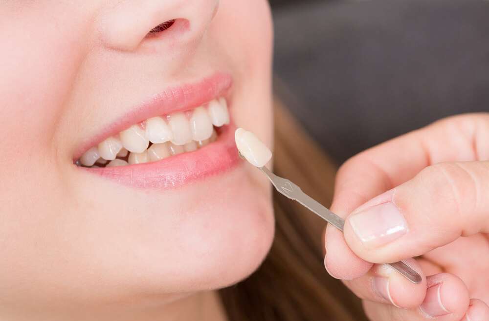 How Much Do Veneers Cost and Are They Worth It?