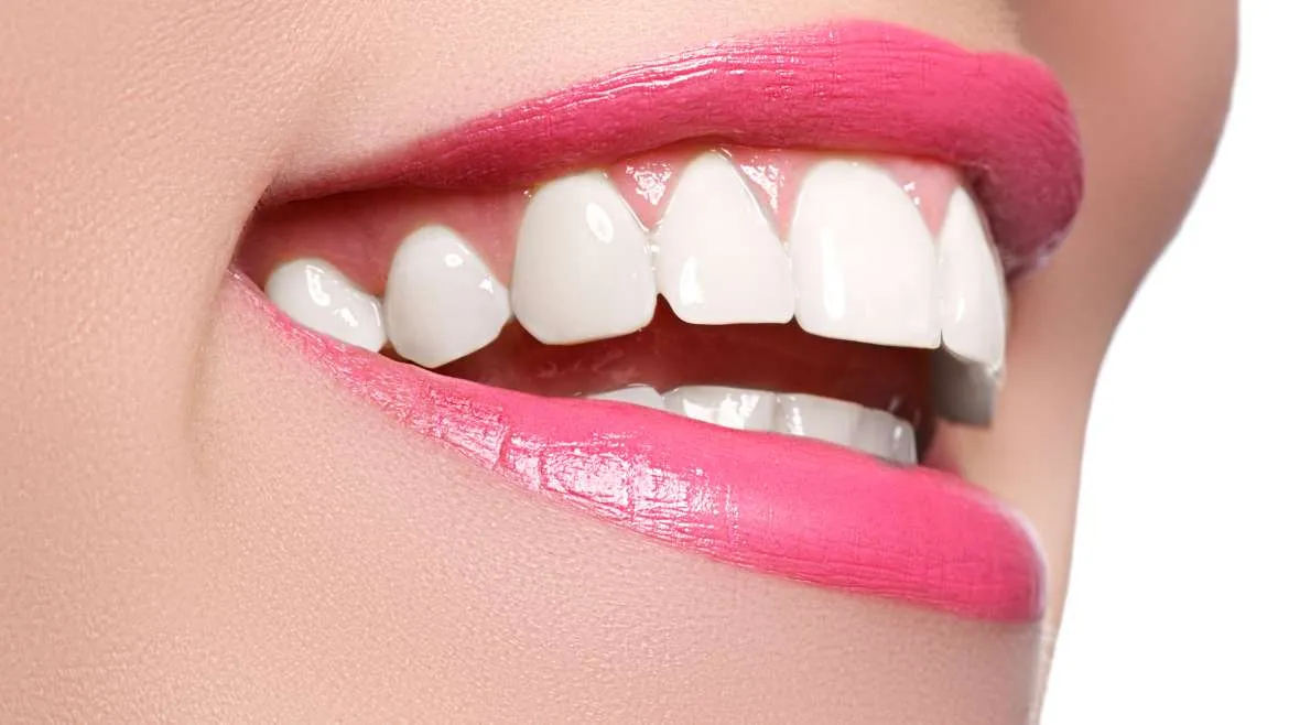 The 5 Steps to Achieving a Beautiful Smile with Veneers