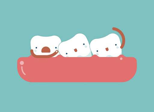 Can I Get Veneers On Crooked Teeth?