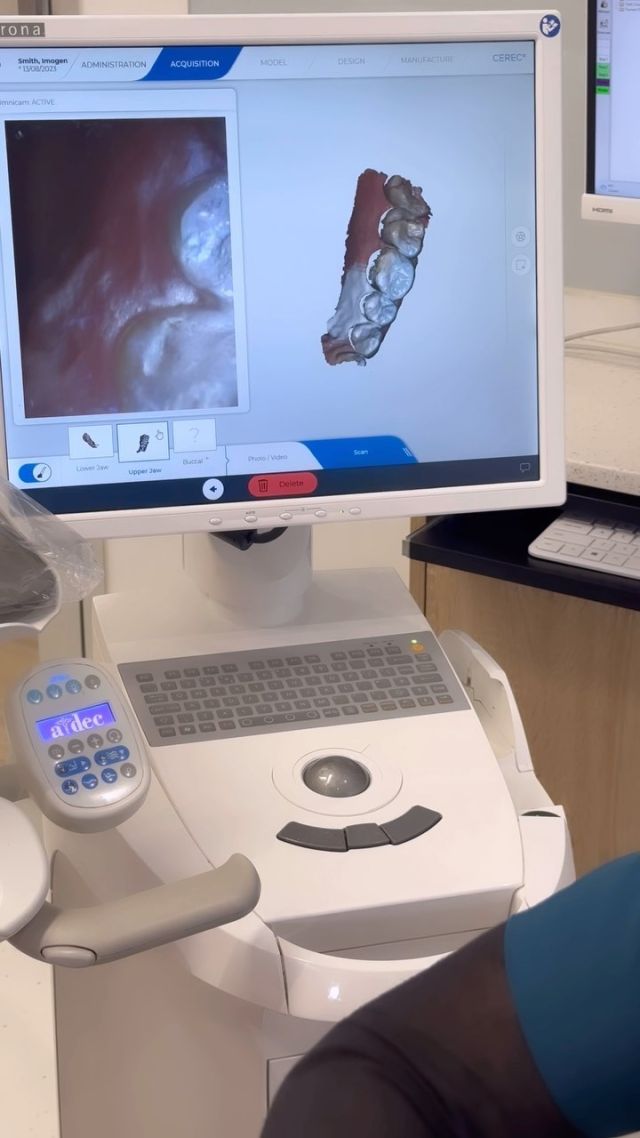 Scanning for Porcelain Crown at Jacobson Dental Group. 
#dentsplysirona#porcelaincrowns#newsmile